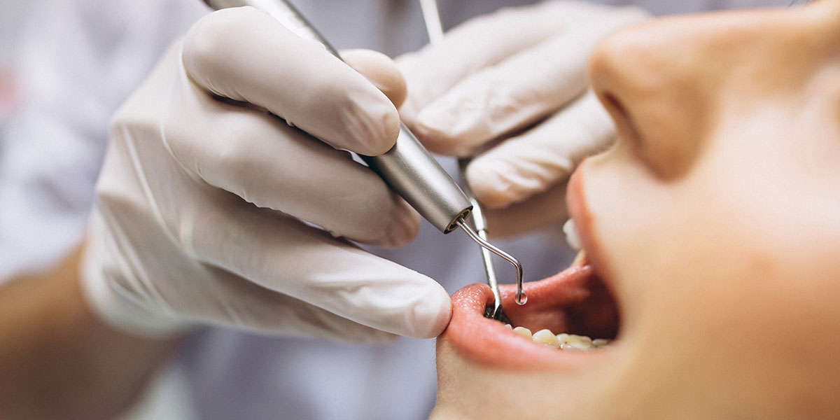 Endodonti